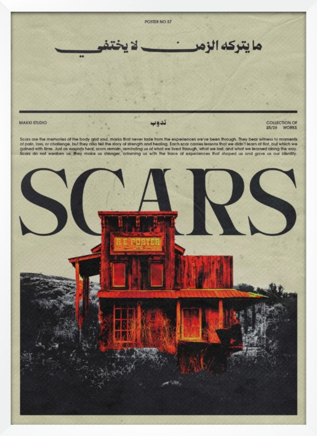 Scars